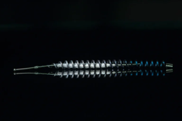 Essure, a Luxury Foreign Body